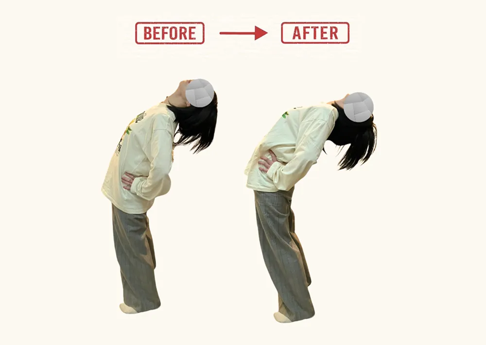 腰痛改善 Before After